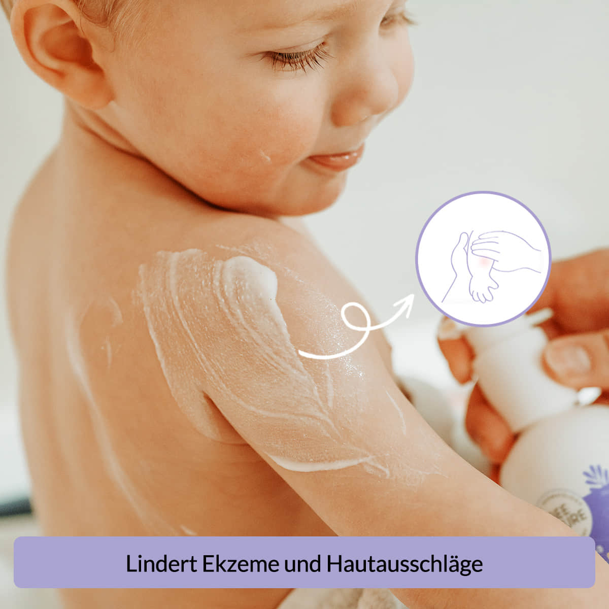 Die beruhigende Wirkung der Baby Körperlotion auf gerötete und trockene Hautstellen.
